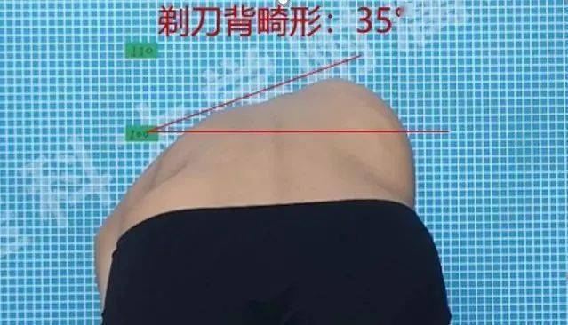 为什么男生腰一挺女生就疼呢(男生怎么判断自己得了性疾病)